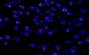 明美顯微成像解決方案：免疫細胞療法與癌癥研究的得力助手