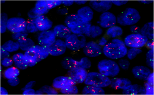 病毒“偵察兵”——揭秘疾控中心病毒實驗室的顯微鏡應(yīng)用