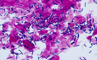 明美顯微鏡在疾控中心微生物檢測實驗室的應(yīng)用