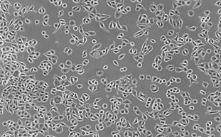 明美顯微鏡在出入境檢驗檢疫局病毒學(xué)實驗室中的應(yīng)用